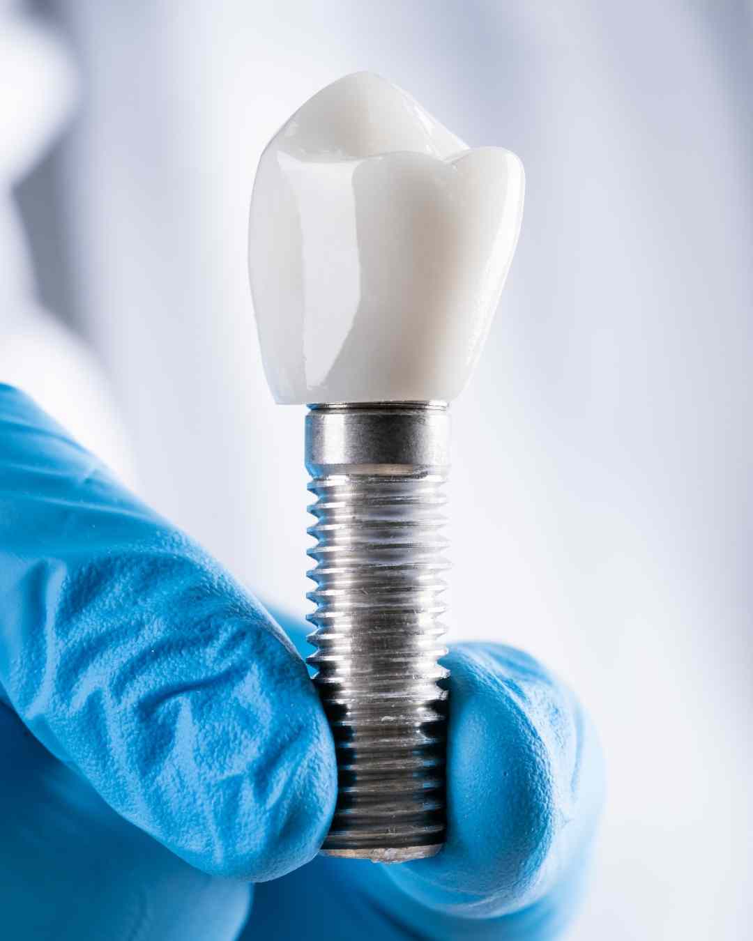 Dr. Christian Salazar, especialista en implantología dental en Bogotá